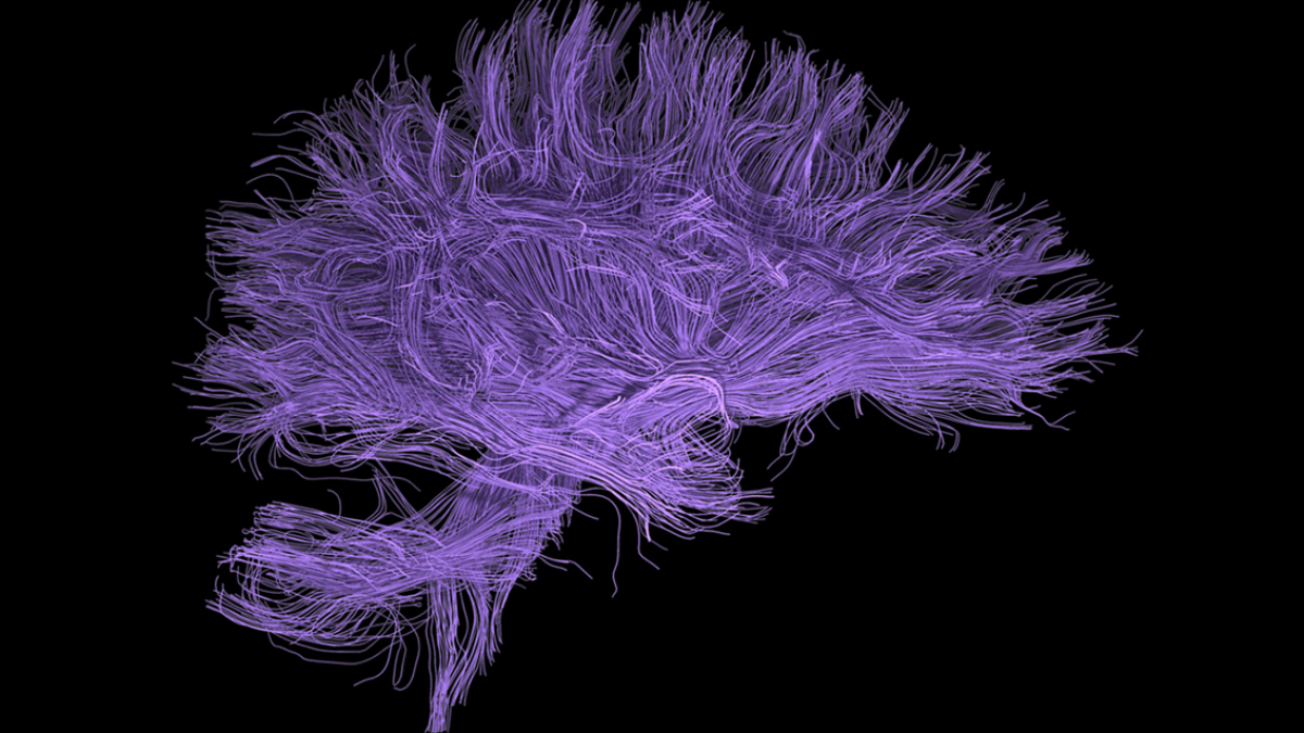 Introducing the Intelligence System brain art made out of threads